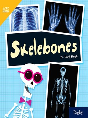 cover image of Skelebones